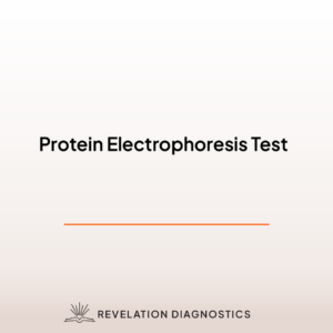 Protein Electrophoresis Test
