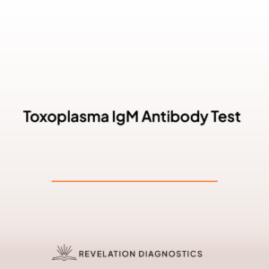 Toxoplasma IgM Antibody Test
